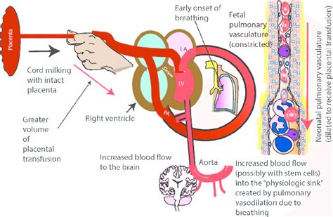 Placental Transfusion Through Cord Milking With An Intact Cord I Ucm Download Scientific
