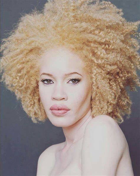 Albino Beauty Modelo Albino Albino Girl Pretty People Beautiful