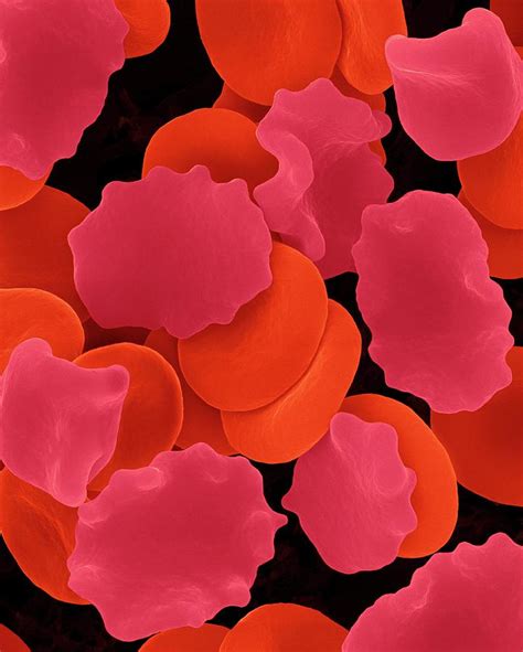 Red Blood Cells In Hypertonic Solution Photograph By Dennis Kunkel Microscopy Science Photo