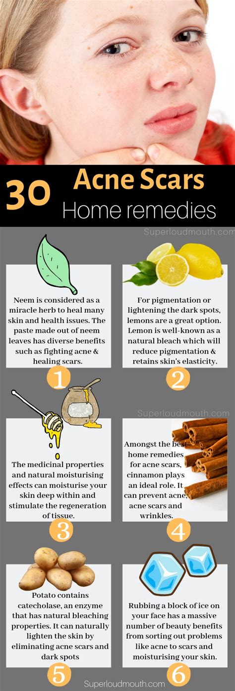 Including honey in your diet and applying a honey mask on the face are two. 30 Natural Home Remedies to heal Acne Scars overnight