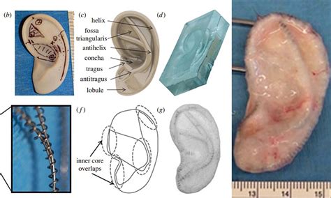 Scientists Build Artificial Ear That Looks And Works Just Like The Real