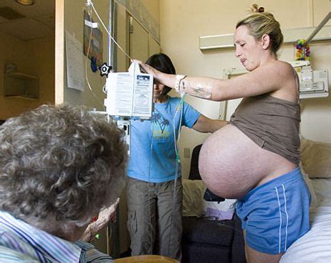 Sextuplet Pregnancy Big Pregnant Baby Bumps Triplets Pregnancy