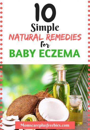 10 Simple Baby Eczema Natural Remedies Baby Eczema Natural Eczema