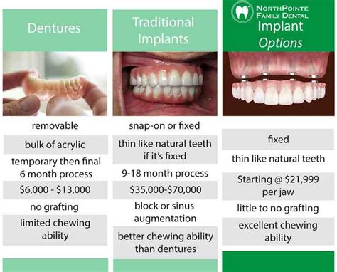 How Much Do Full Mouth Dental Implants Cost Dental News Network