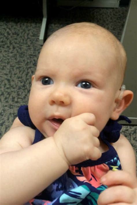 Deaf Baby Hears Moms Voice For The First Time