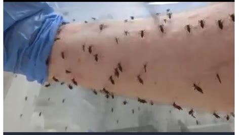 Mientras Sigan Las Lluvias Continuará La Invasión De Mosquitos