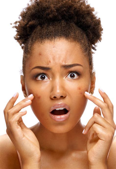 Everything You Need To Know About Acne And Finding A Dermatologist Southlake TX Compassion