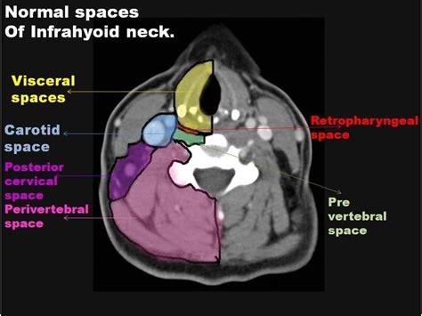 Pin By Valentina On 4to Radiology Imaging Medical Anatomy Radiology