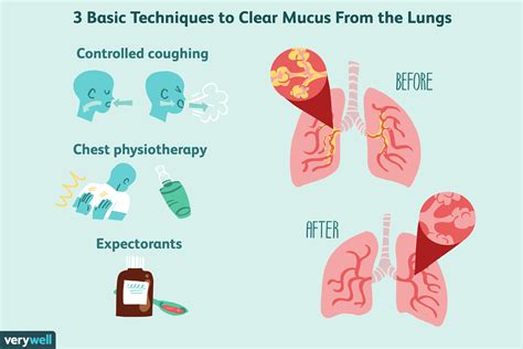 How To Clear Mucus From Your Lungs If You Have Copd