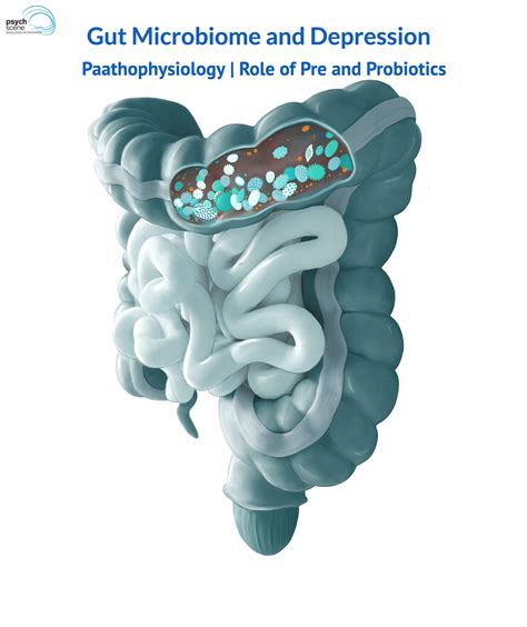 Gut Microbiome And Depression Pathophysiologyrole Of Pre And Probiotics