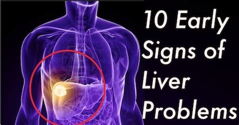 Signs Of Liver Problems Skin Changes Abdominal Changes Frequent