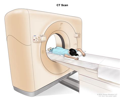 Figure Computed Tomography Ct Scan The Pdq Cancer
