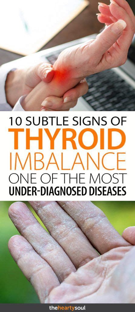 Symptoms Of Thyroid Problems 10 Signs To Watch Out For In 2020