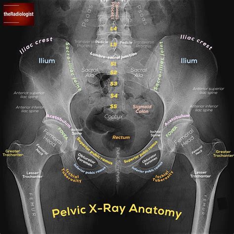 Clinical Anatomy Pelvic Anatomy Review Vrogue Co