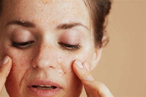 These Are The Signs Of A Damaged Skin Barrier—and How To Fix It