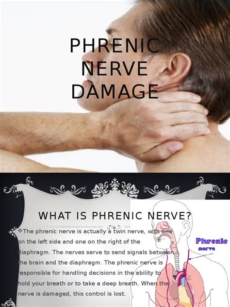 Phrenic Nerve Damage Pdf Artificial Cardiac Pacemaker Cardiac Surgery