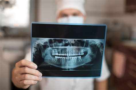 ¿qué Es Una Radiografía Dental Panorámica Colgate