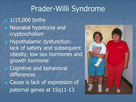PPT 2013 Update On Endocrine Complications In Prader Willi Syndrome