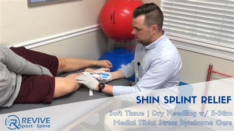 Shin Splints Treatment Dry Needling Therapy Running Injury Mtss