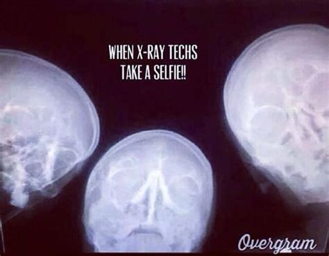 What X Ray Techs See When They Take A Selfie Lol Xray Humor