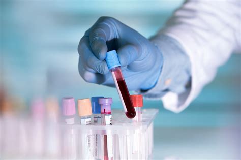 Blood Test Leads To Quicker Cheaper Way Of Detecting Brain Injuries