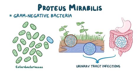 Proteus Mirabilis Disease