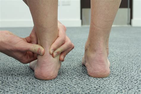 Dislocation Of The Peroneal Tendons The Ankle Biomechanical