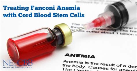Treating Fanconi Anemia With Cord Blood Stem Cells