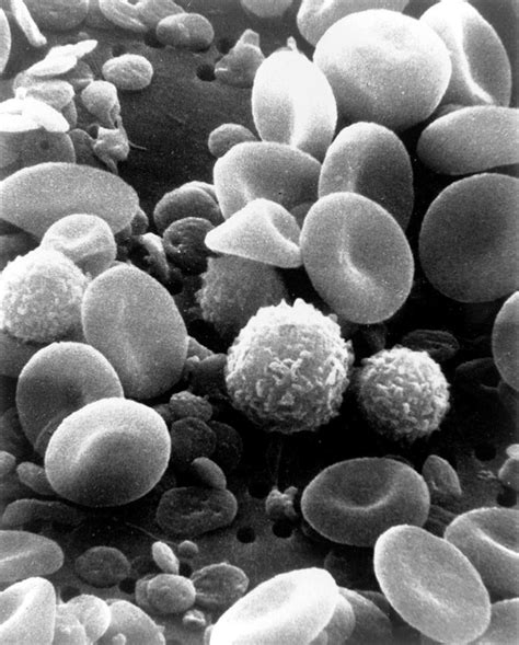 White Blood Cell Alchetron The Free Social Encyclopedia