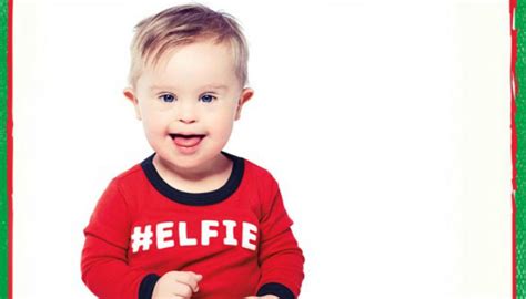 Each person born with down syndrome is different. OshKosh B'gosh Features Boy With Down Syndrome In Holiday Ads