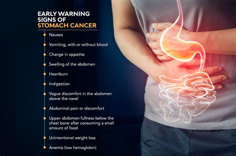 Early Warning Signs Of Stomach Cancer