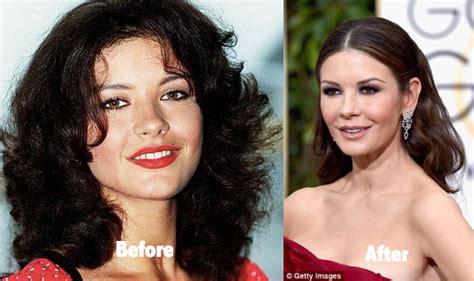Catherine Zeta Jones Plastic Surgery Before And After Photos