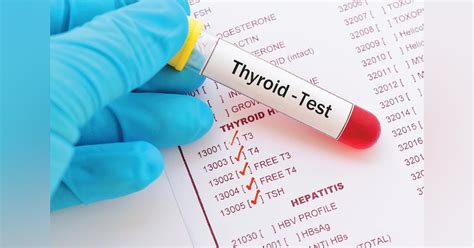 Endocrinology Screening And Reasons Behind Delayed Testing Medical