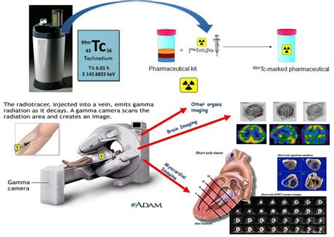 Technetium 99m Imaging Technetium 99mtc For Cardiac Imaging