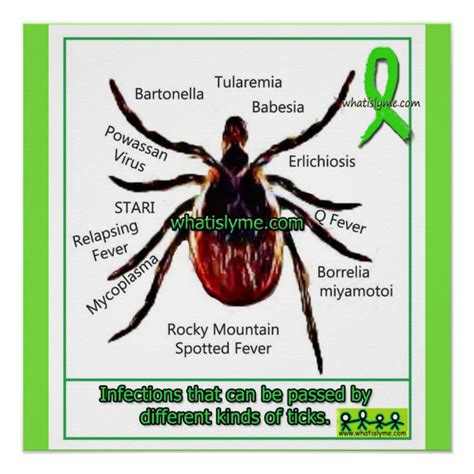 Lyme Disease And Co Infection Educational Chart Zazzleca