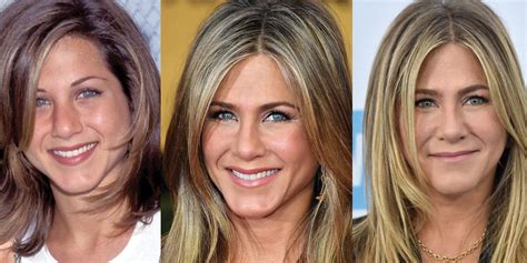 Jennifer Aniston Plastic Surgery Before And After Pictures 2023