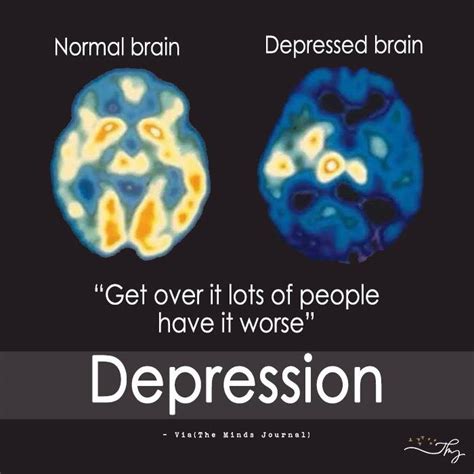 Normal Brain Vs Depressed Brain