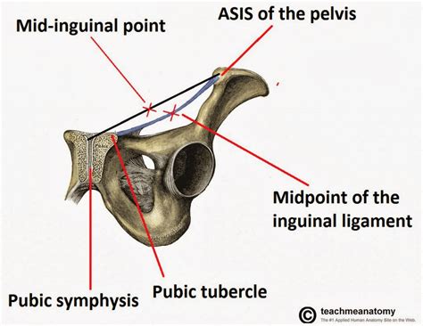 The inguinal canal (canalis inguinalis; What I learned today...: Question of the Day... Femoral ...