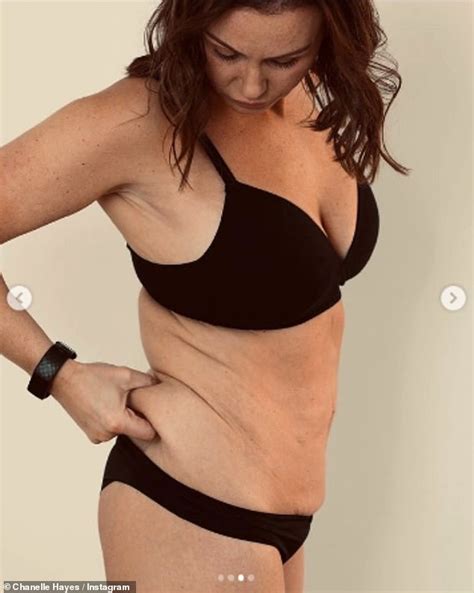 Chanelle Hayes Proudly Shows Off Her Saggy Stretched Wobbly Bits In