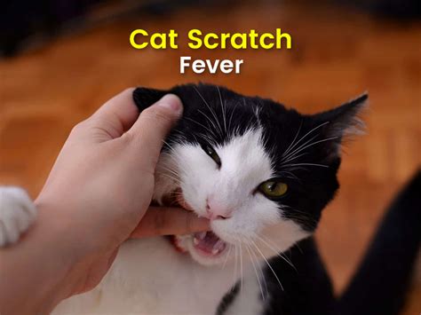 All You Need To Know About Cat Scratch Fever Symptoms Causes