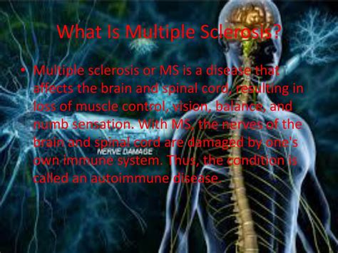 Ppt Multiple Sclerosis Powerpoint Presentation Free Download Id 1867691