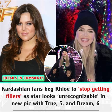 Kardashian Fans Beg Khloe To ‘stop Getting Fillers As Star Looks