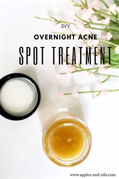 Pin By Nicole Cedarleaf On Diy Homemade Remedies Acne Spot