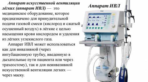 Калиевая диета наиболее эффективна Искусственная вентиляция легких - online presentation Искусственная вентиляция легких - online presentation Калиевая диета наиболее эффективна