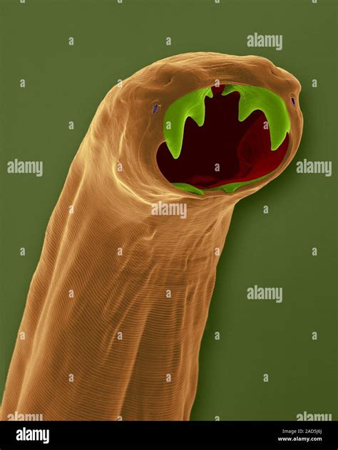 Coloured Scanning Electron Micrograph Sem Of Cat Hookworm Buccal
