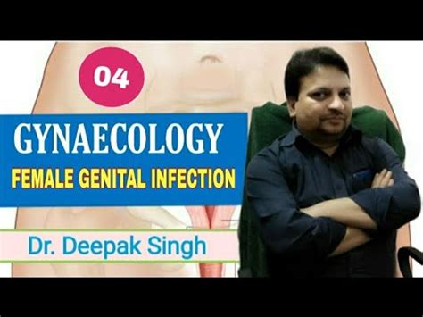 Female Genital Infection Cause Diagnosis And Sexual Transmission