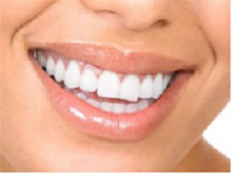 How To Whiten Your Teeth Naturally At Home Hubpages
