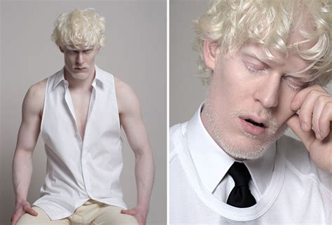 Albino Model Stephen Thompson By Christos Karantzolas Albino Model