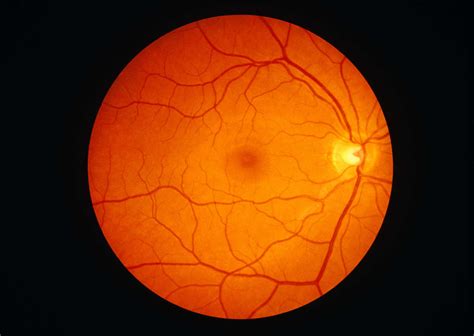 Digital Retinal Imaging Eye Test