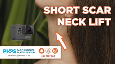 Gopro Short Scar Neck Lift Pacific Heights Plastic Surgery Dr
